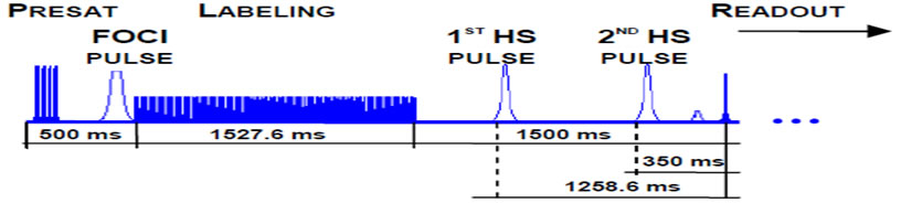 pcasl and background suppression