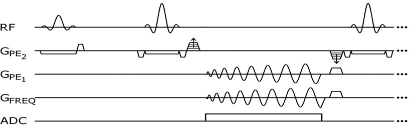 spiral readout
